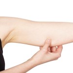 Loose Upper Arm