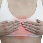 Acute pain in a woman chest