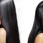 remedy-for-dandruff