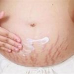 castor oil5